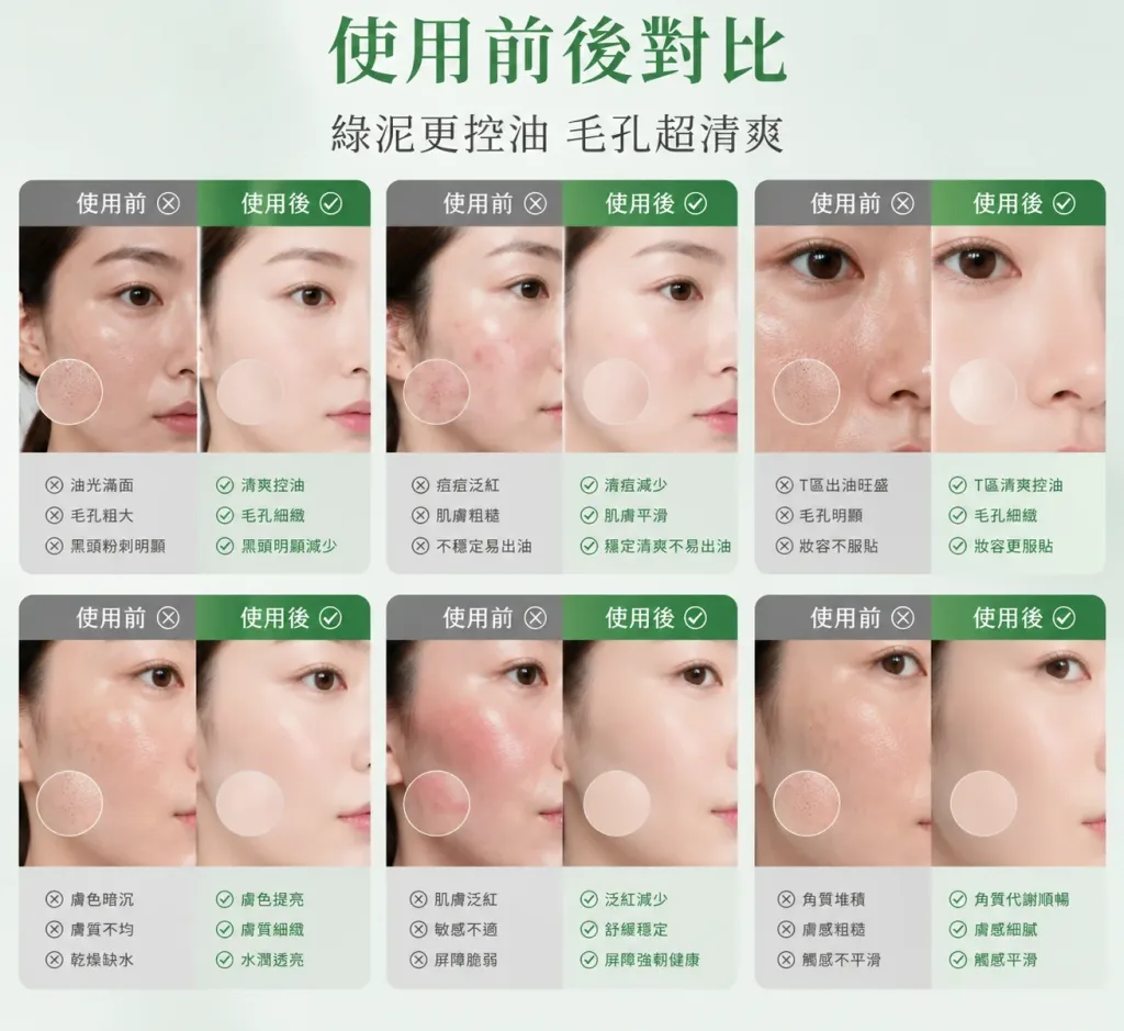 🍃 BUV 綠泥控油深層清潔洗面乳 🍃 ✨ 告別大油田!還你一整天的清爽呼吸肌 ✨ 你是不是也常覺得臉上油光滿面、黑頭粉刺拔了又長?😰 那是因為毛孔在向你發出求救訊號啦!📢 這款 BUV 綠泥洗面乳 專為「油痘肌、混合肌」量身打造,結合了天然綠泥的強大吸附力,深層清潔不緊繃,洗出掐出水來的透亮好膚質!💦 - 13